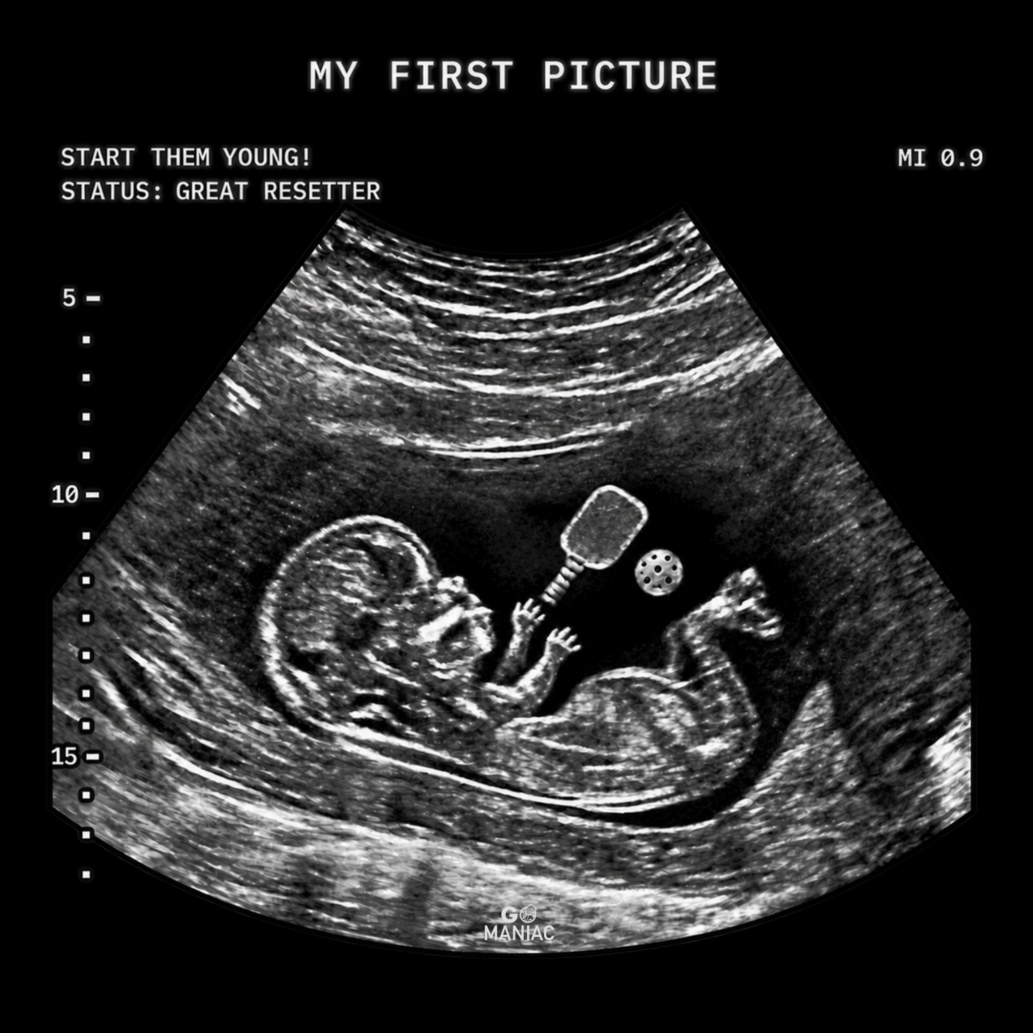 Ultrasound design detail